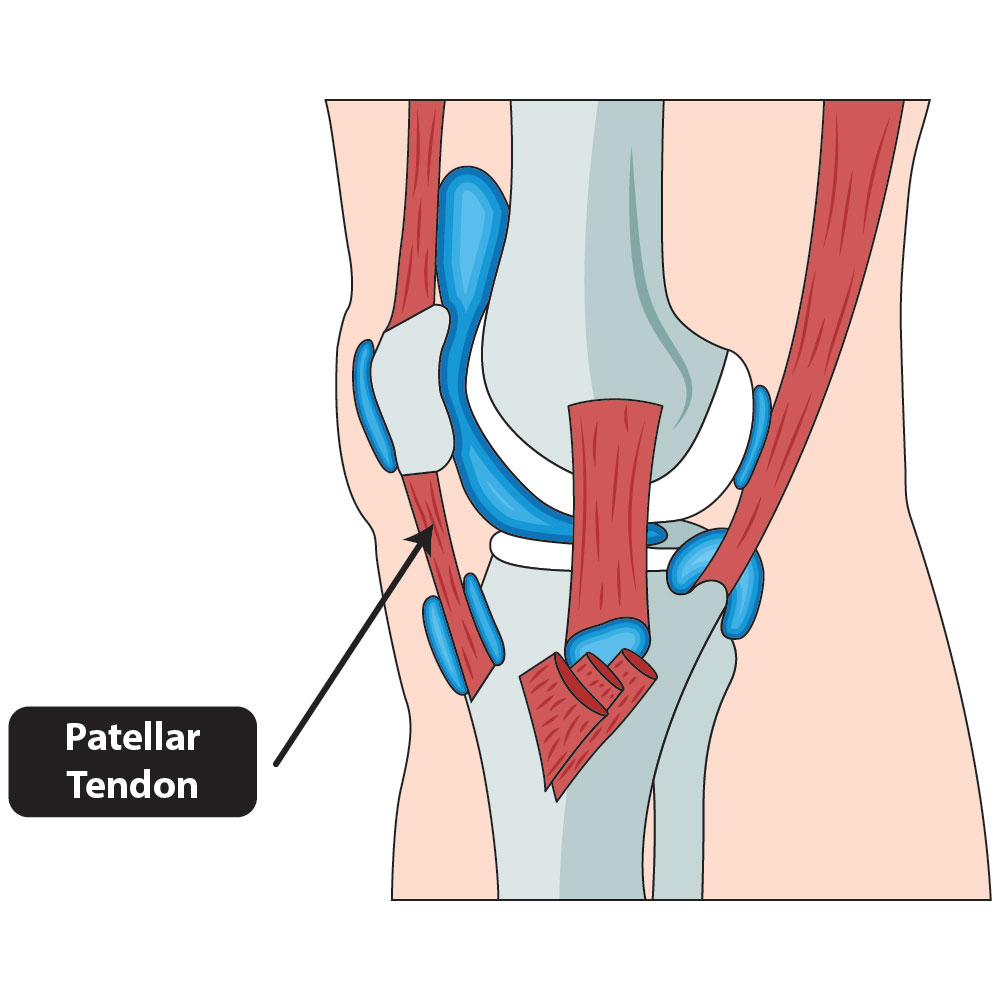 The-Knees_patellar-tendon
